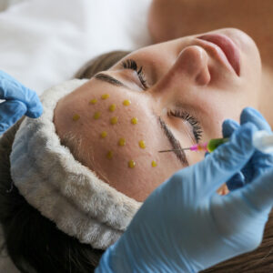 Пилинг Biorepeel (3процедури)+ Celluma Led Mask (3 процедури)